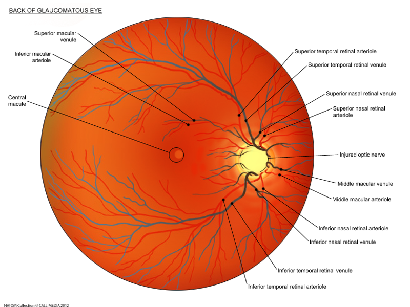 back of glaucomatous eye