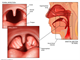 oral cavity   tonsil enlargement