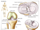knee meniscus