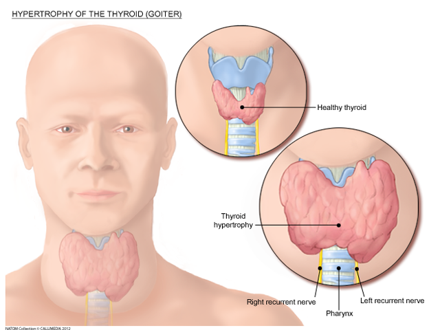 Thyroid gland.png