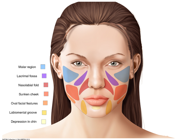 Neurology - descriptive areas of the face.png