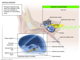 Ear - cross section of inner ear to explain deafness maybe vertigo.png