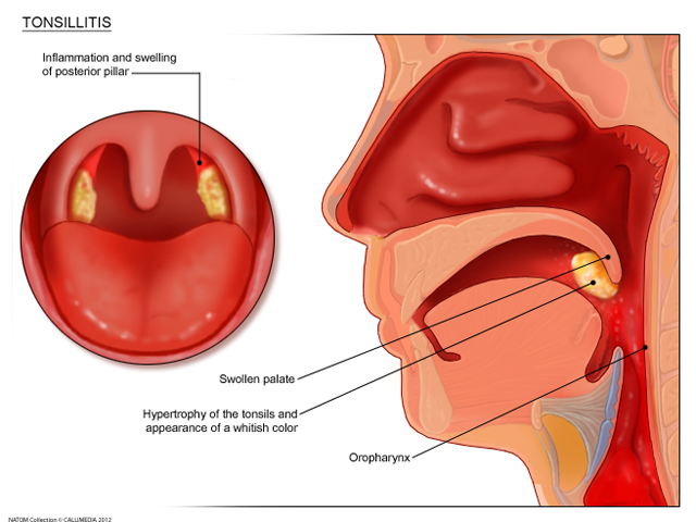 Oral cavity - tonsils.png