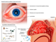 allergies- rhinitis -allergic conjuncyivitis.png