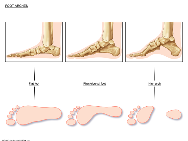 foot - flat foot.png