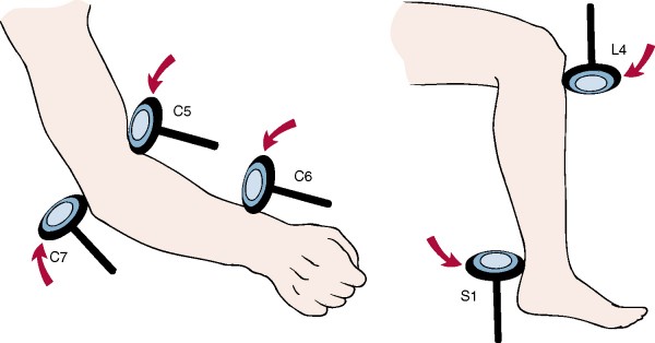 Reflexes - Nerve Roots.jpg