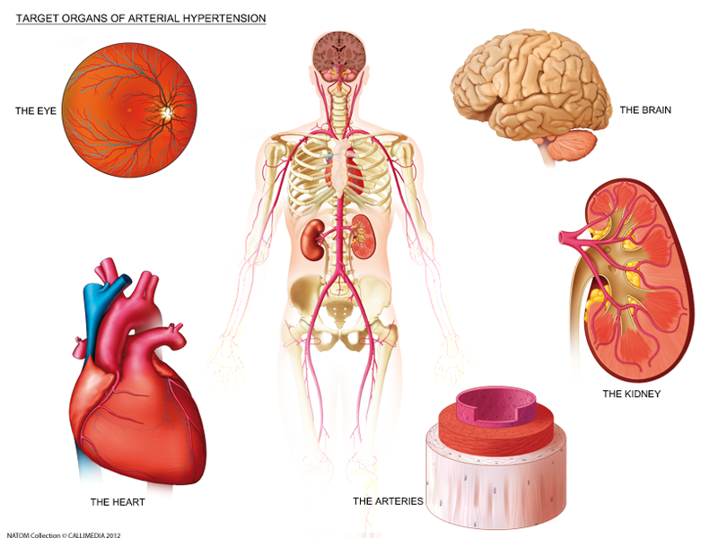 hypertension end organ damage.png